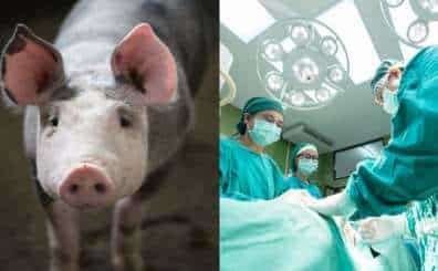 "Medical Marvel: Surgeons Make History with Successful Pig-to-Human Kidney Transplant"